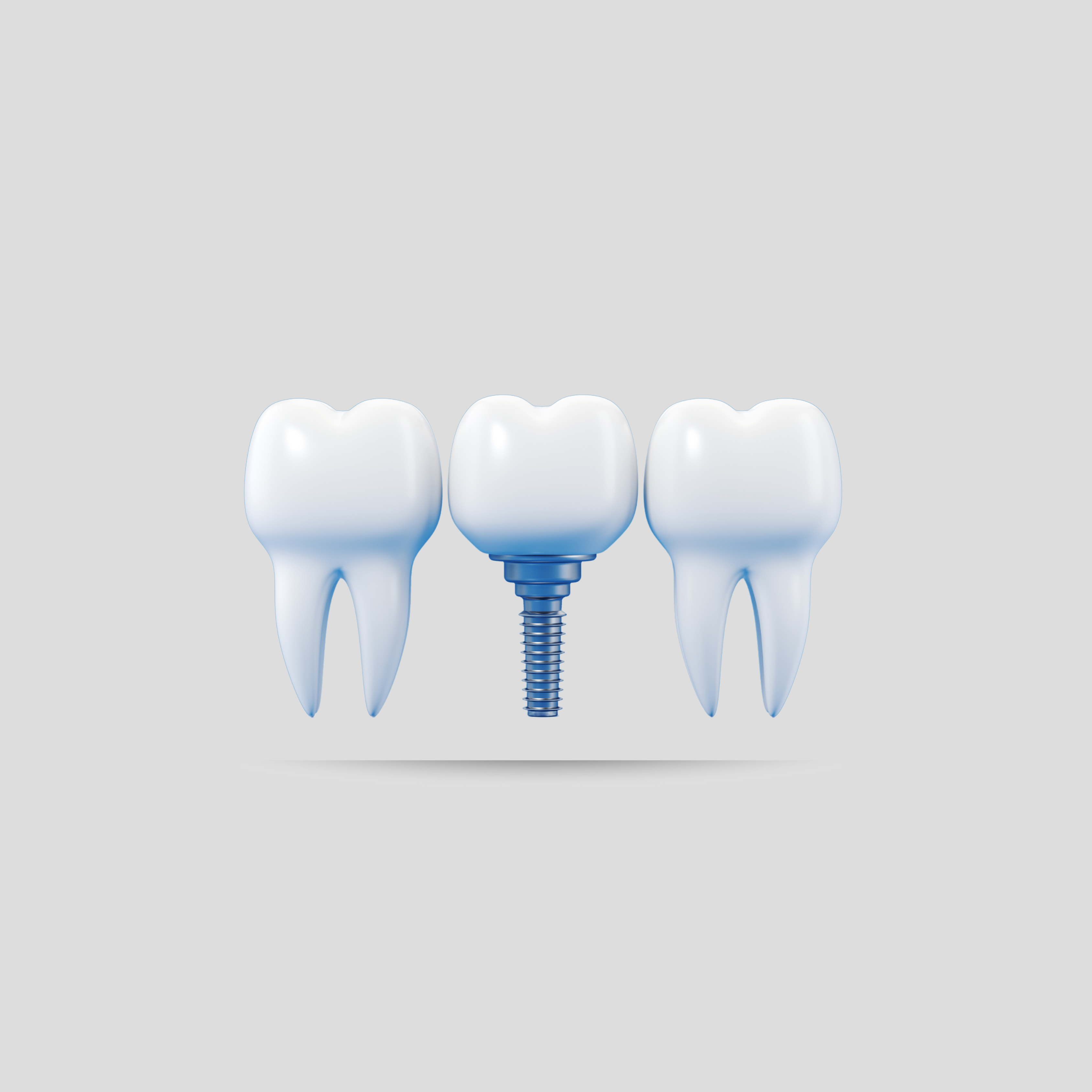 mi_manca_un_dente_cosa_devo_fare.png