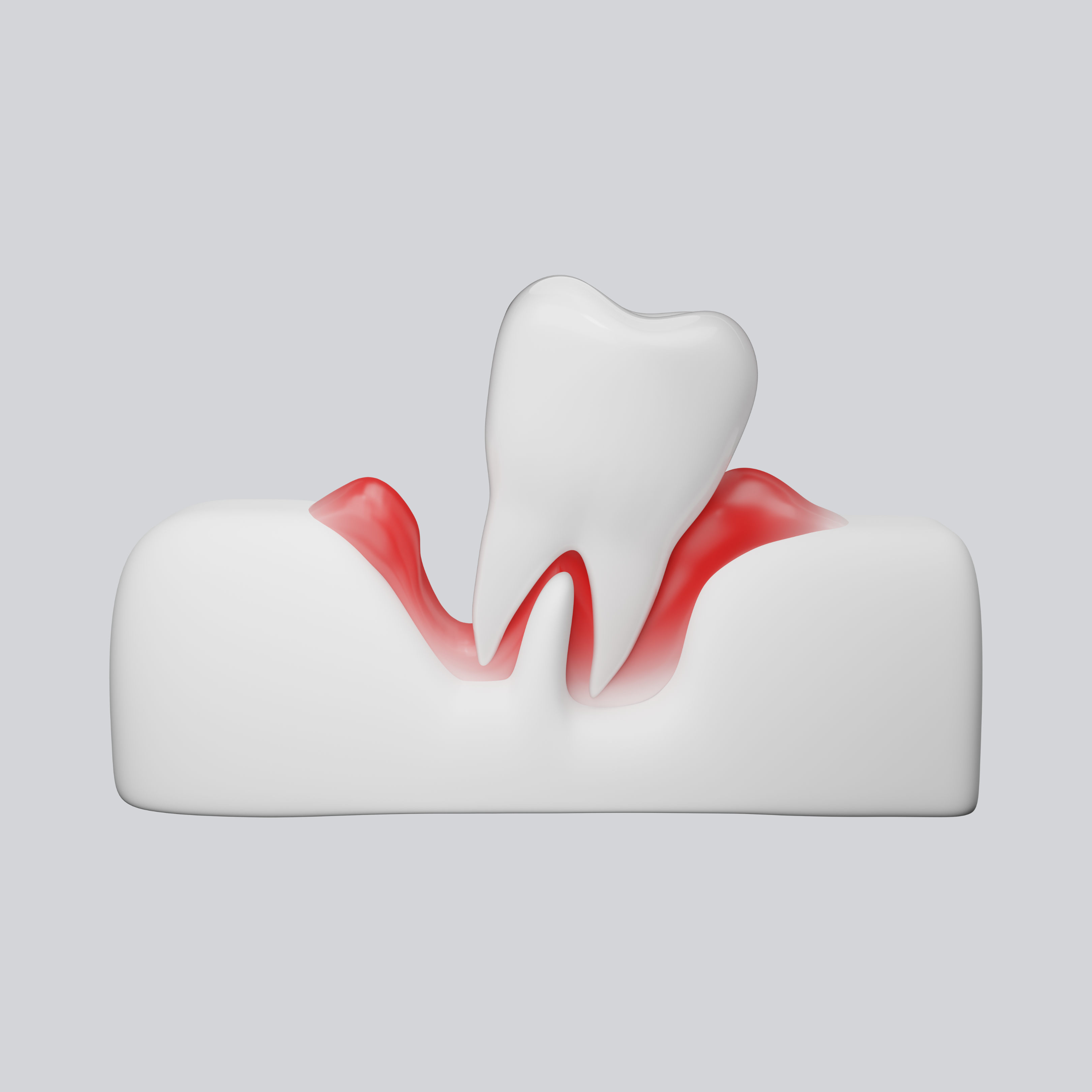 Gengive doloranti e gonfie? Scopri le cause comuni come gengivite e parodontite, i sintomi e i trattamenti efficaci per la salute orale. Visita Bclinic per maggiori informazioni.