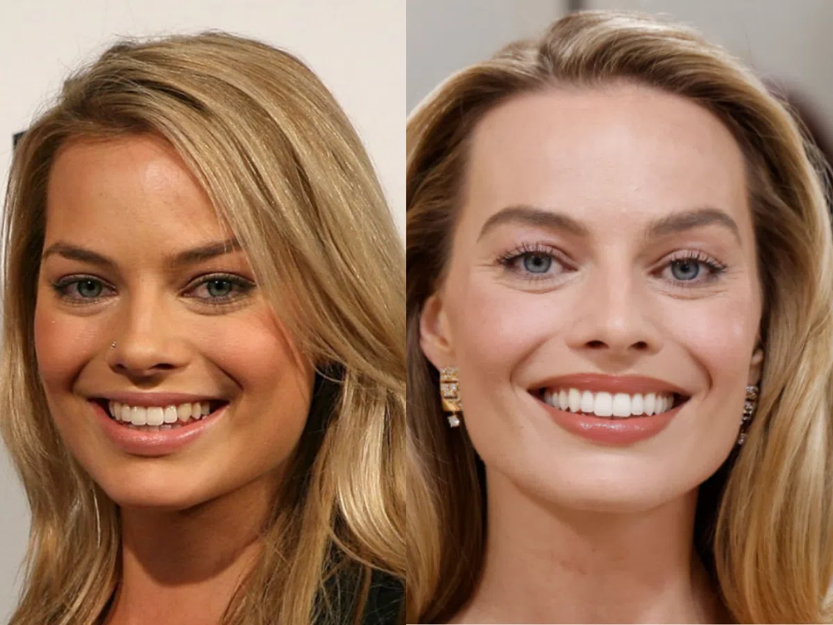 faccette dentali Margot Robbie